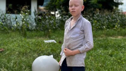 Türk STK’ler Tanzanya’daki albino çocuklara bayram sevinci yaşattı