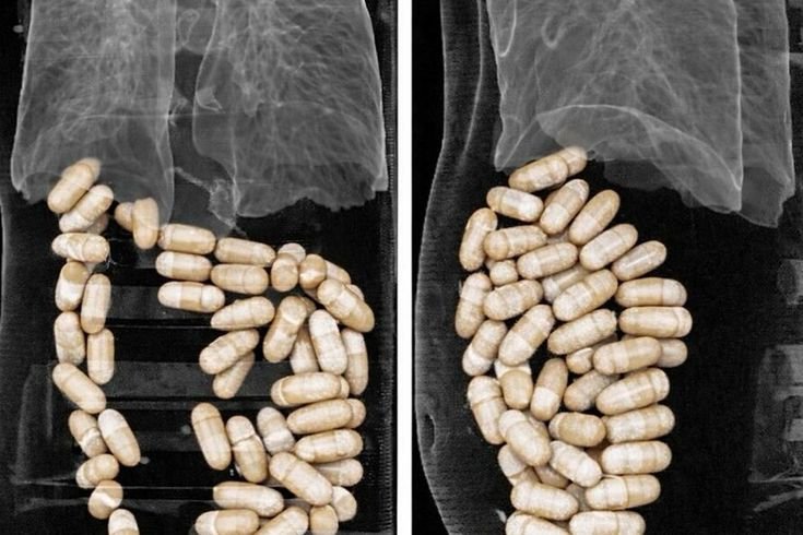 İzmir'de 2 şüphelinin midesinden 1 kilo 304 gram uyuşturucu çıktı